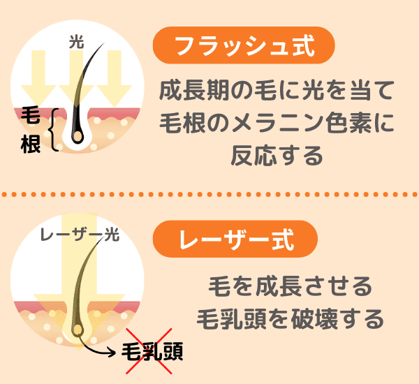家庭用脱毛器 人気おすすめ14選を比較｜上手な選び方も徹底解説